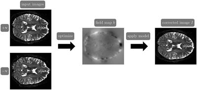 PyHySCO: GPU-enabled susceptibility artifact distortion correction in seconds